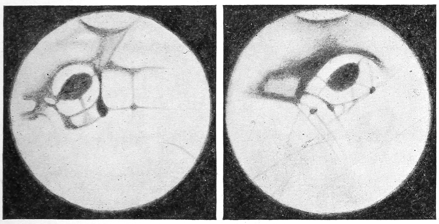 Figs. 33–34.—Drawings of Lacus Solis on Mars, by Messrs. Campbell and Hussey. — Two drawings of the same region, Campbell's on the left and Hussey's on the right; each shows the dark oval of Lacus Solis inside a white border, but with different streaks and channels running from it.