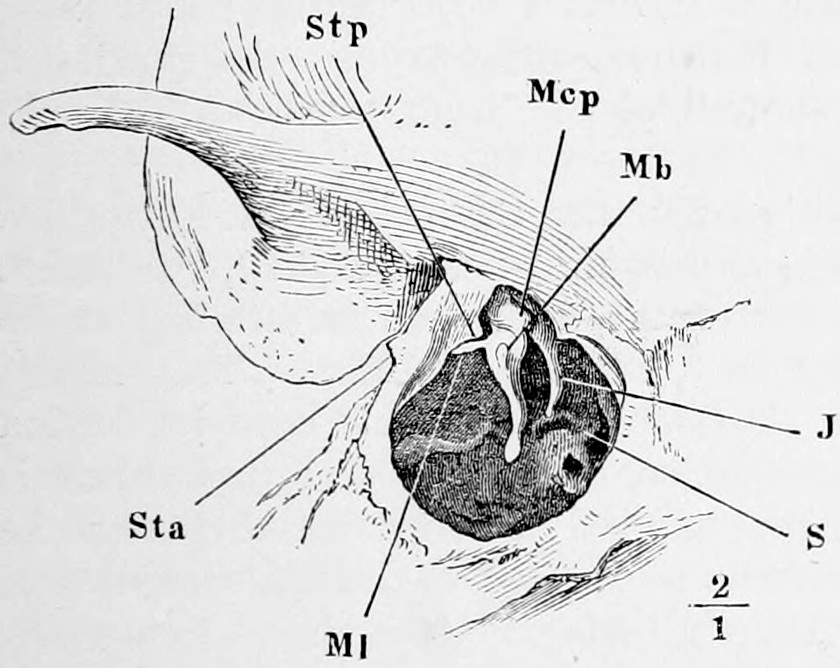 Fig. 39. Left temporal bone of a newly-born child, with the auditory ossicles *in situ*. Sta, spīna tympănica antĕrior. Stp, spīna tympănica postĕrior. Mcp, head of the hammer. Mb short, Ml long process of hammer. J anvil. S stirrup. — The outer side of a newborn child's temporal bone with the drumskin removed, showing the dark round cavity of the drum with the small hammer, anvil and stirrup lying in it, at twice natural size.