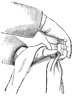 Fig. 79. — The four coins seized through an outer fold of the handkerchief between the thumb and fingers of the right hand, the handkerchief hanging down loosely around them.