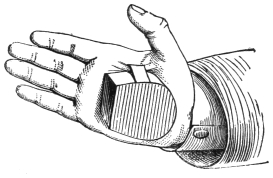 Fig. 115. — The hand box clipped by its spring to the fleshy part of the open palm, its open end toward the fingers.