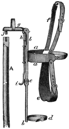 Fig. 315. — The iron corset by itself beside the rod A: the girdle a a and shoulder strap f, the upright b b with its hip joint c and leg strap d, the crutch e, and at the top the arm-piece g with its plug j, check h and hook i.