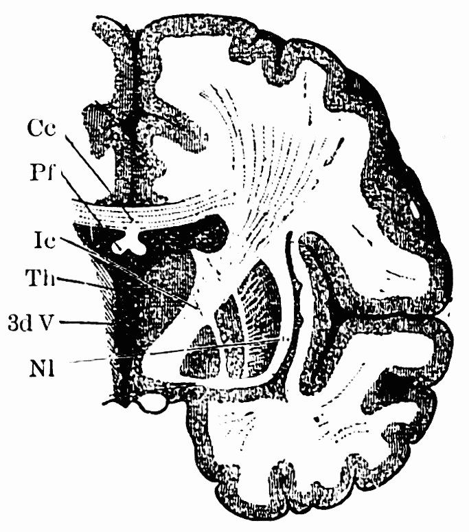 Fig. 38. —Transverse section through right hemisphere (after Gegenbaur). Cc , corpus callosum; Pf , pillars of fornix; Ic , internal capsule; V , third ventricle; Nl , nucleus lenticularis. — A slice across one hemisphere, its gray rind folded around white matter: near the midline sit the corpus callosum and third ventricle, and lower down the internal capsule runs between thalamus and the striped nucleus lenticularis.
