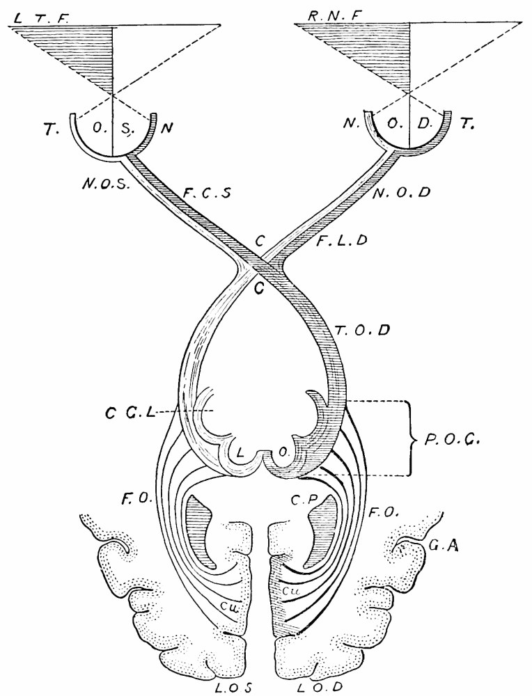 Fig. 45. —Scheme of the mechanism of vision, after Seguin. The cuneus convolution ( Cu ) of the right occipital lobe is supposed to be injured, and all the parts which lead to it are darkly shaded to show that they fail to exert their function. F.O. are the intra-hemispheric optical fibres. P.O.C. is the region of the lower optic centres (corpora geniculata and quadrigemina). T.O.D. is the right optic tract; C , the chiasma; F.L.D. are the fibres going to the lateral or temporal half T of the right retina, and F.C.S. are those going to the central or nasal half of the left retina. O.D. is the right, and O.S. the left, eyeball. The rightward half of each is therefore blind; in other words, the right nasal field, R.N.F. , and the left temporal field, L.T.F. , have become invisible to the subject with the lesion at Cu . — A diagram of the visual paths: two eyeballs at the top with their fields of view, the optic nerves crossing at the chiasma, the tracts running back through the lower optic centres, and fibres fanning out to the cuneus of each occipital lobe, with the injured right-hand pathway shaded dark.