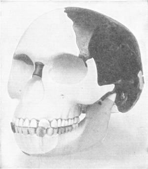 The Piltdown Skull, as Reconstructed from Original Fragment. Nat. Hist. Mus. — A reconstructed skull in white plaster, with the dark original fragments set into the top and side of the braincase and into the lower jaw.