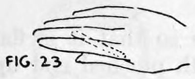 Fig. 23. — Right hand with the cigarette pulled back between the first and second fingers toward the palm, seen from the side.