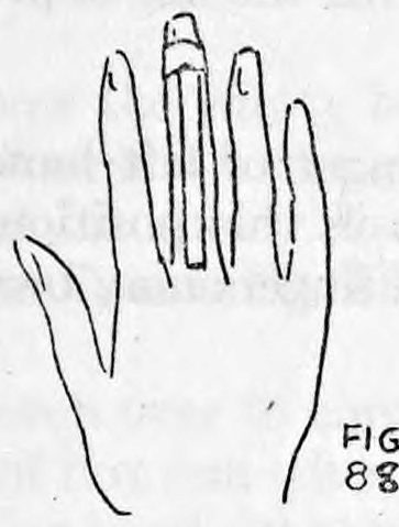 Fig. 88. — The back of the right hand held upright with fingers together, the Cigarette Clip and cigarette lying along the back of the second finger.