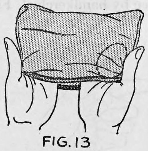 Fig. 13. — Both hands holding the bag turned inside out, with the pocket on the rear side and the outline of the egg showing through the cloth.