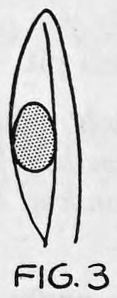 Fig. 3. — The bag seen edge-on as a narrow pointed shape, with a round egg hidden between its double sides.