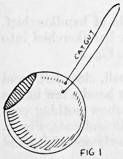 Fig. 1. — The handkerchief ball, a round metal shell with an opening in one side and a thin catgut thread running through two small holes at the top.