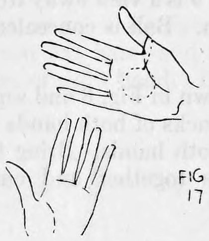 Fig. 17. — Both palms exposed with fingers spread, the ball outlined in dots hidden behind the upper hand.