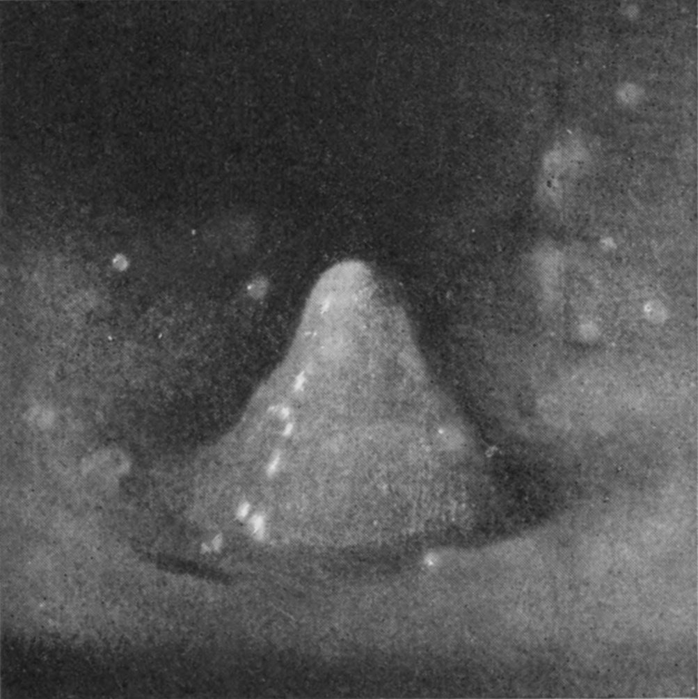 10 0·105 sec. — The bubble has opened early and gone, leaving the column standing alone as a tall rounded cone, with a few drops about its base.