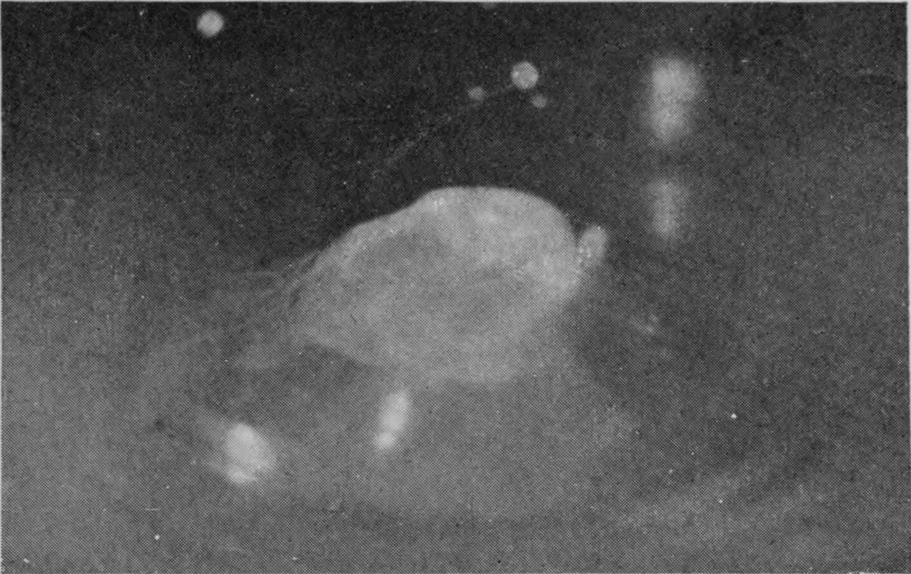 11 0·105 sec. — The bubble has closed too firmly to reopen: a lumpy, furrowed dome lies on the surface, its summit struck by the column rising within.