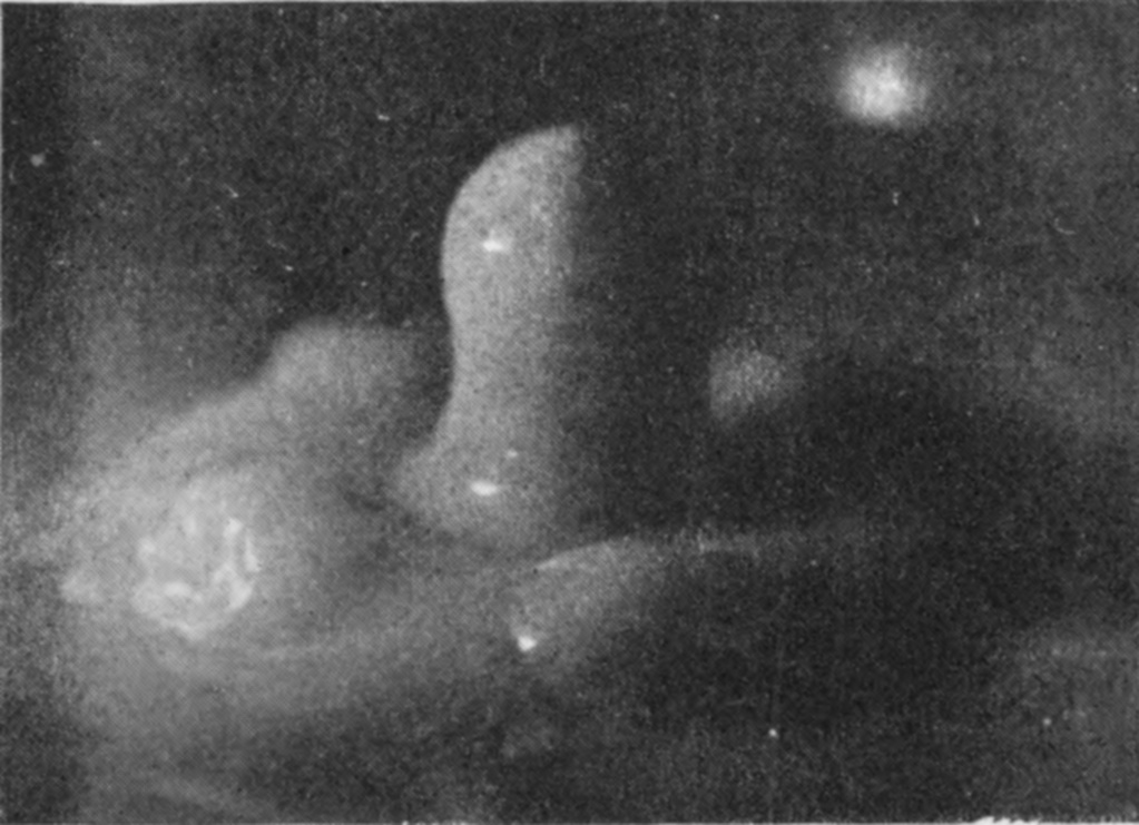 15 0·194 sec. — The column, bent over toward the right at its top, rises from a broad cloudy mound of liquid spreading out on the left.