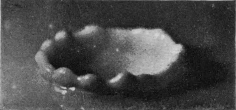 10 0·060 sec. — The crater has sunk to a low, lumpy ring, its wall thick and its lobes reduced to rounded swellings.