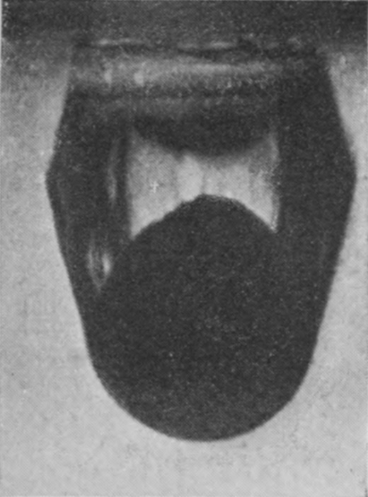 2 0·010 sec. — The sphere, now under water, drags the surface down after it in a shallow bag of air, with the blurred lip of the crater above.