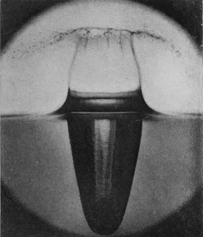 2 0·003 sec. — The crater walls rise tall and curve inward, their rim torn into spray, while the air-cavity below is long and tapering.